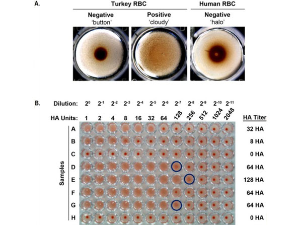 Hemagglutination using Turkey Red Blood Cells